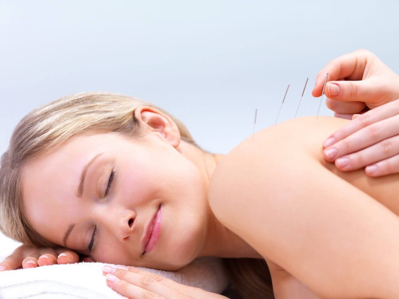 Acupuncture in Milton