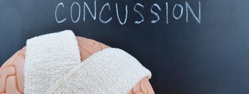 Baseline testing for Concussions