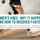 Runners Knee